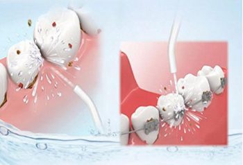Los mejores irrigadores dentales para cuidar tu higiene bucal imagen 3 funcionamiento del irrigador