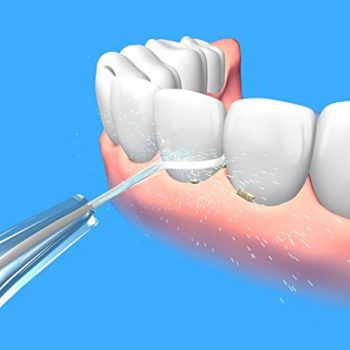 irrigador bucal para limpieza dental