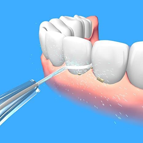 Los mejores irrigadores dentales para cuidar tu higiene bucal imagen 10 irrigador bucal para limpieza dental