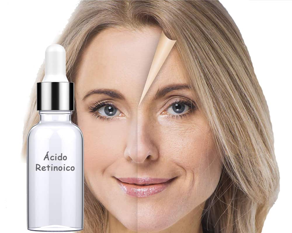 Quels ingrédients les produits anti-âge devraient-ils avoir? image 4 acide rétinoïque dans les produits anti-âge