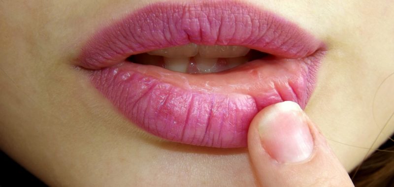 Cómo hidratar los labios de forma natural imagen