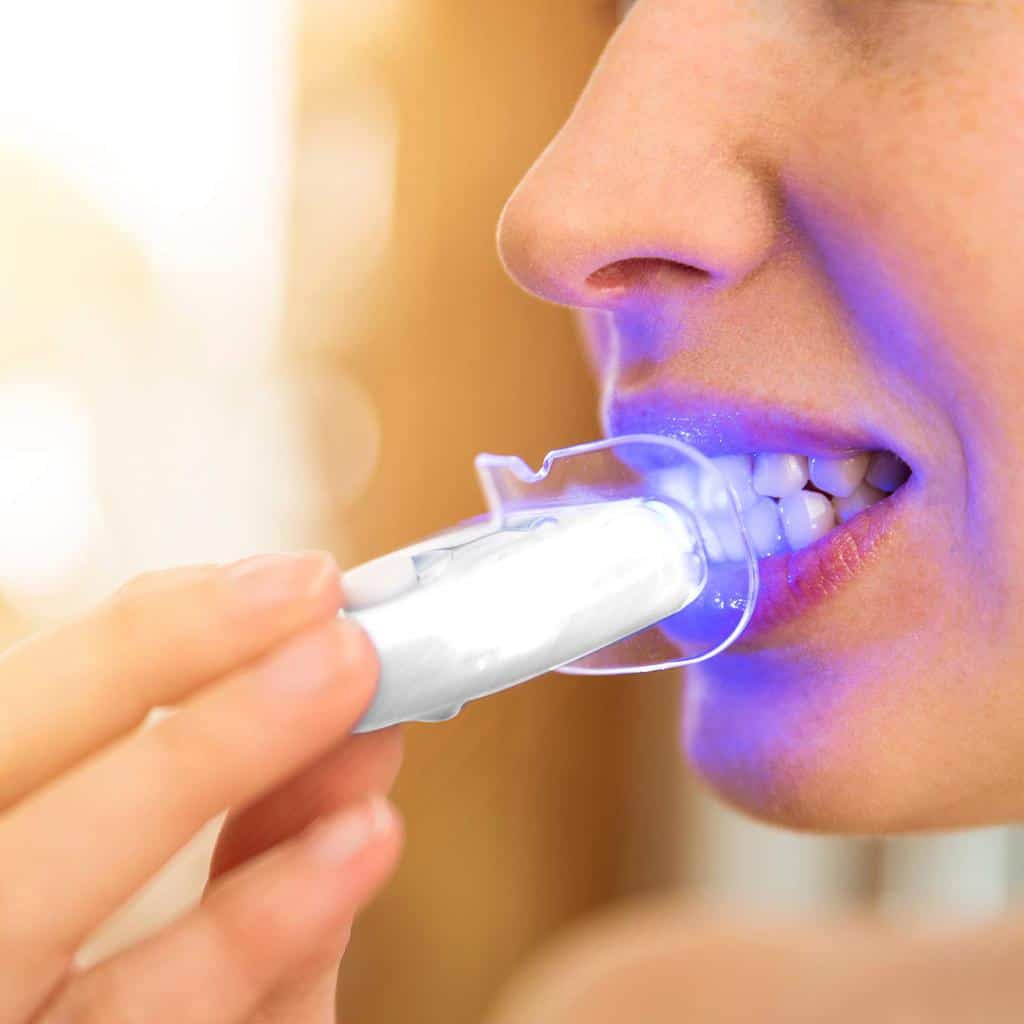 Cómo elegir el mejor blanqueador dental