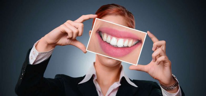 blanqueador dental para una sonrisa perfecta