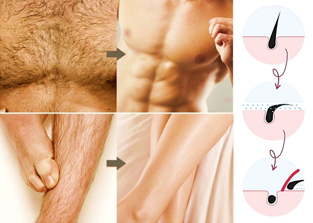 Cuál es la mejor crema depilatoria para hombres imagen 3 Cómo funciona la crema depilatoria