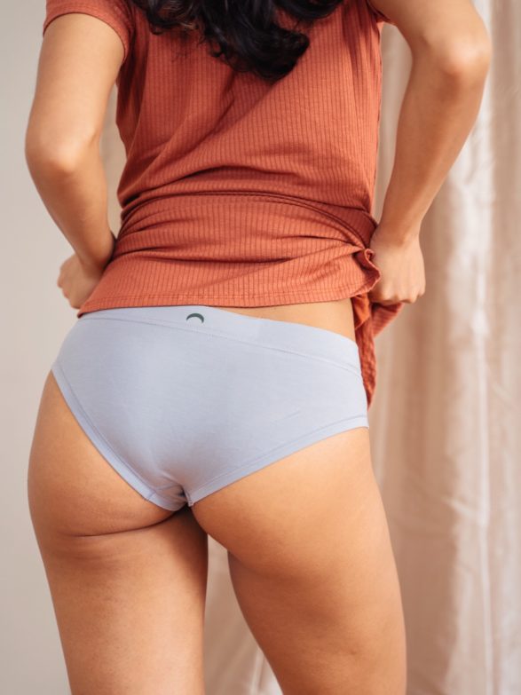 Piernas femeninas con estrías