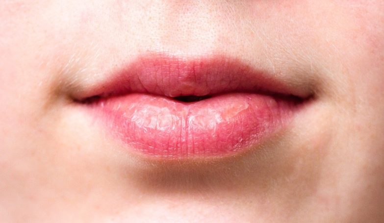 labios secos que necesitan un exfoliante de labios